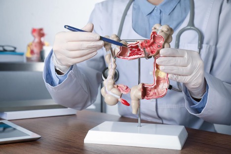 gastroenterologist-showing-human-colon-model-colonoscopy-concept